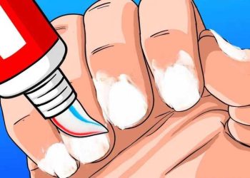Beauty-Hack: Warum jetzt alle Zahnpasta auf ihre Nägel schmieren